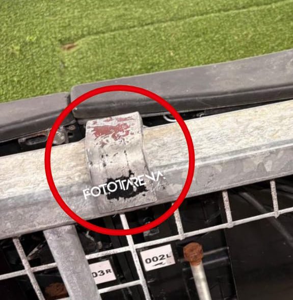 记者：导致诺阿·朗手指受伤的是锋利部件，当时部件是打开的